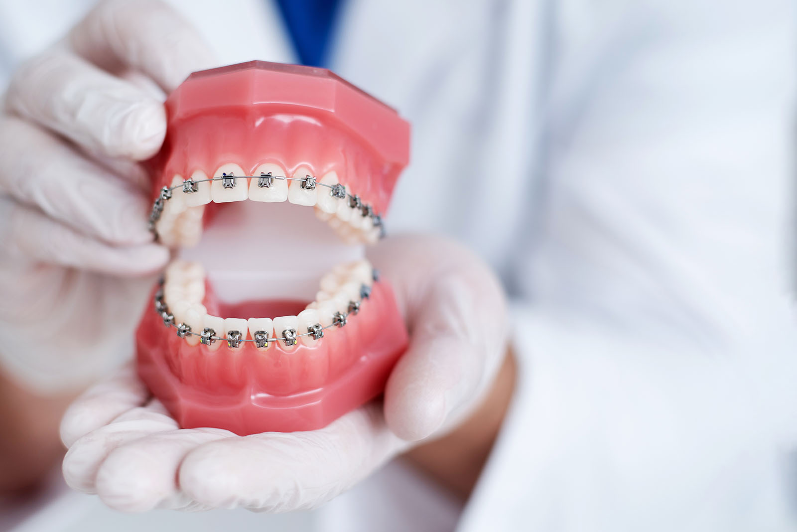 An individual wearing white gloves holds an open mouth model with visible teeth and gums, showcasing dental implants.