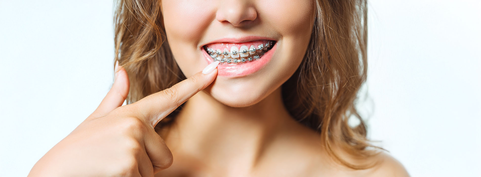 A woman with straight white teeth is smiling at the camera while holding her hand near her mouth.