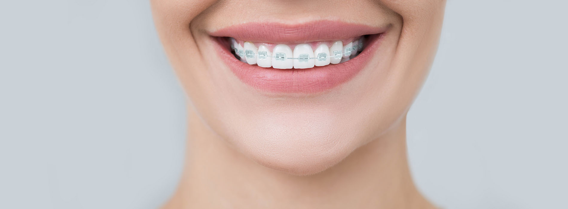 The image shows a person with a radiant smile, showcasing their dental work, against a white background.