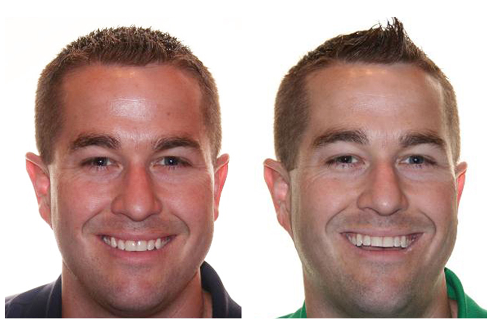 O Keiff Orthodontics