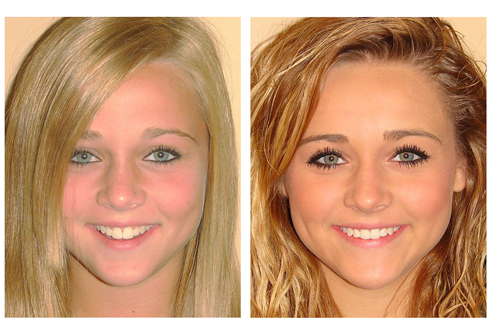 O Keiff Orthodontics